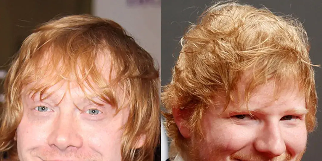 Zdjęcie Czy Ed Sheeran grał w Harrym Potterze? Prawda o plotkach i spekulacjach